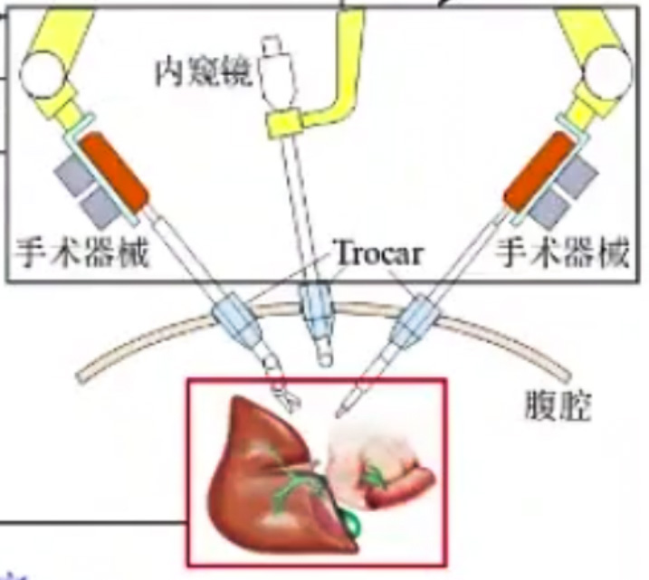 腹腔鏡手術(shù)機器人結(jié)構(gòu)設(shè)計原理—AIP艾普